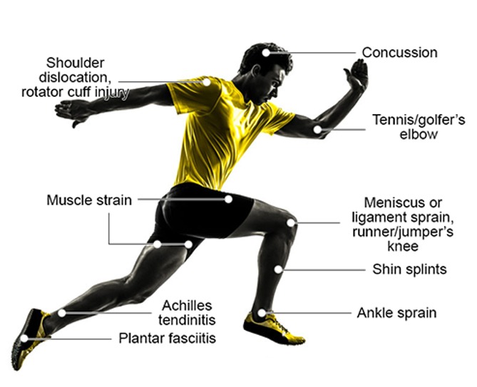 Sports Injury