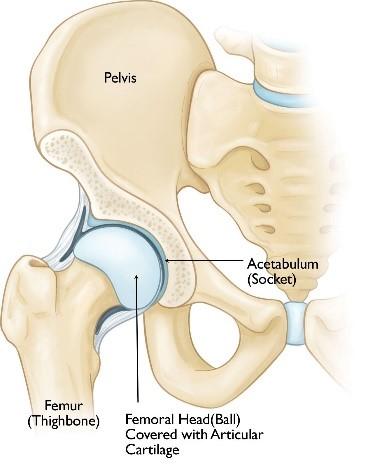Hip joint replacement Hip joint replacement
