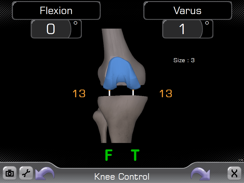 Knee-control-Computer-navigation