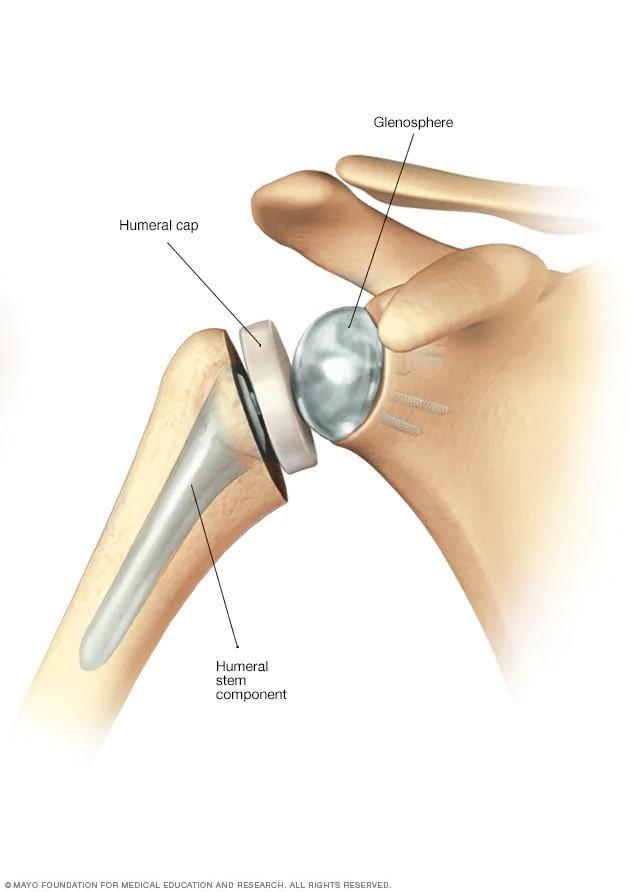 socket-bone