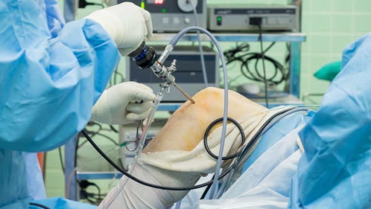 Knee Arthroscopy surgery Knee Arthroscopy surgery