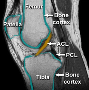 MRI of the Knee MRI of the Knee